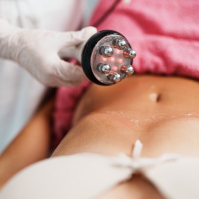Cavitation RF body treatment and contemporary medicine for health beauty improvement and fat and cellulite removal